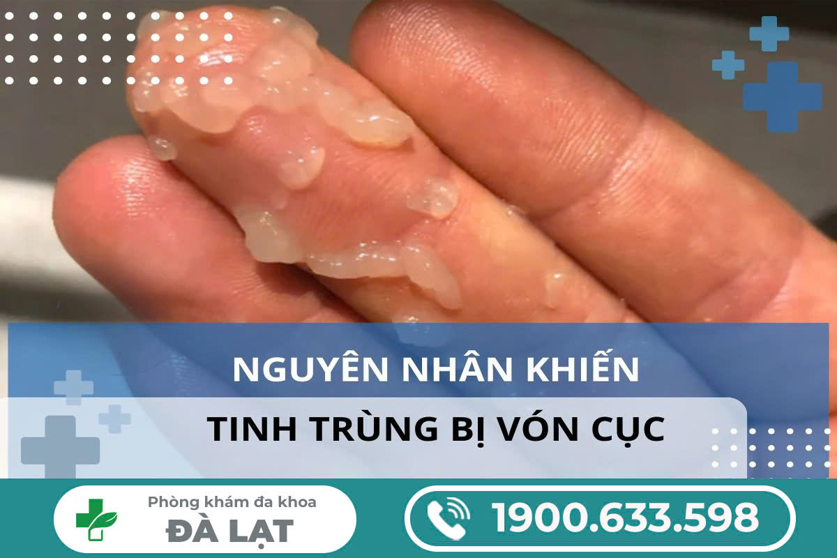 Hình ảnh minh họa